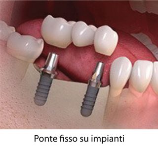 https://prestigedental.al/wp-content/uploads/2021/02/bbbtext-320x299.jpg