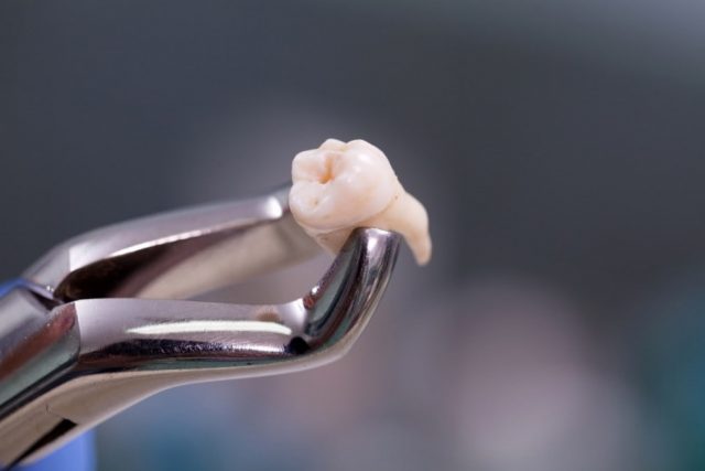 https://prestigedental.al/wp-content/uploads/2021/02/chirur333min-640x427.jpg