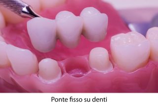 https://prestigedental.al/wp-content/uploads/2021/02/ddtext-320x216.jpg