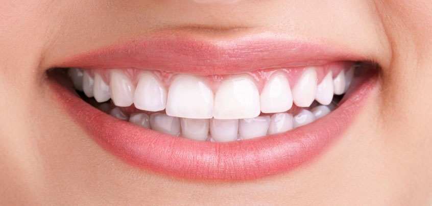 <span class="bt_bb_before_after_image_after_text">Dopo</span>