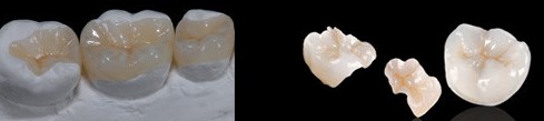 https://prestigedental.al/wp-content/uploads/2021/02/hhhhhhhh.jpg