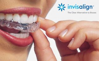 https://prestigedental.al/wp-content/uploads/2021/02/invasefsdfsdfmin-320x199.jpg