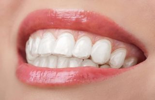 https://prestigedental.al/wp-content/uploads/2021/02/jjkksdssmin-320x207.jpg
