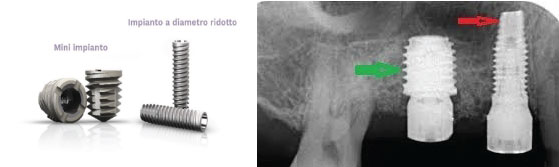 https://prestigedental.al/wp-content/uploads/2021/02/sesese222.jpg