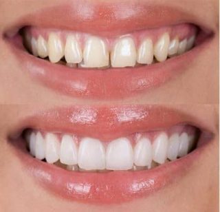 https://prestigedental.al/wp-content/uploads/2021/02/uuujjjjddmin-320x308.jpg